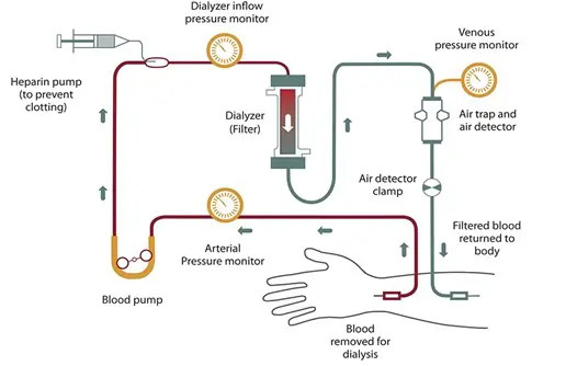 Deprived Citizen Hemodialysis Service